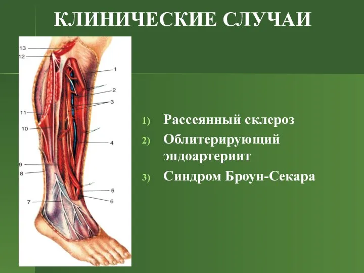 КЛИНИЧЕСКИЕ СЛУЧАИ Рассеянный склероз Облитерирующий эндоартериит Синдром Броун-Секара