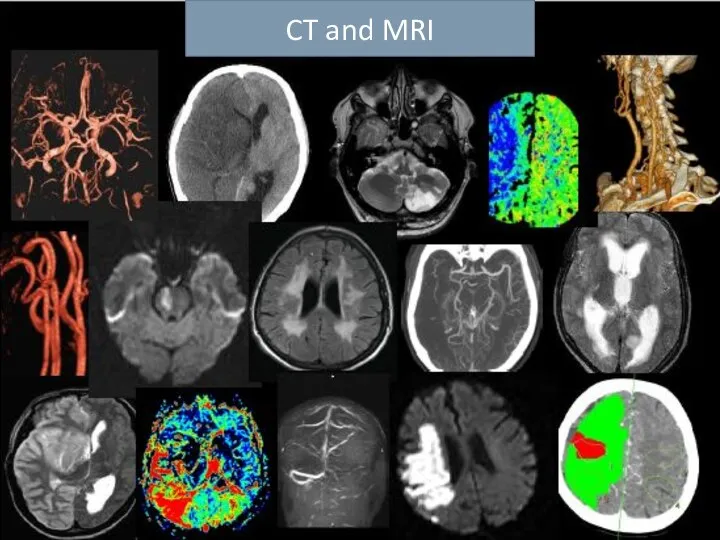 CT and MRI