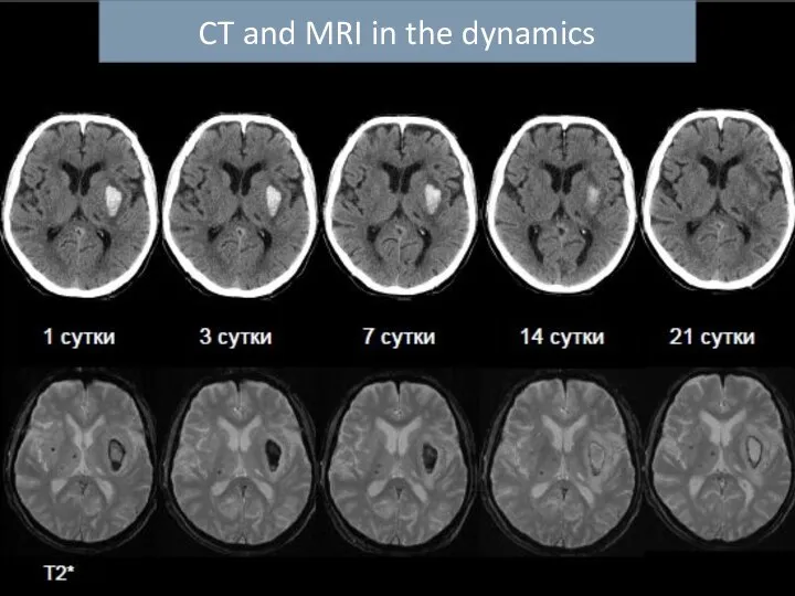 CT and MRI in the dynamics