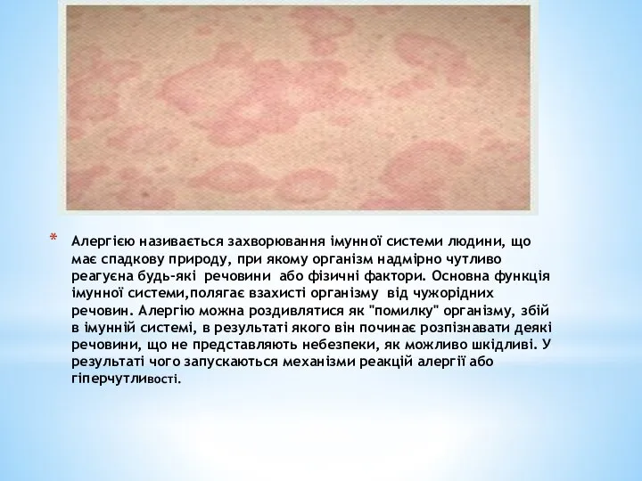 Алергією називається захворювання імунної системи людини, що має спадкову природу, при якому