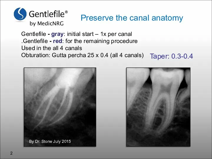 Gentlefile - gray: initial start – 1x per canal Gentlefile - red: