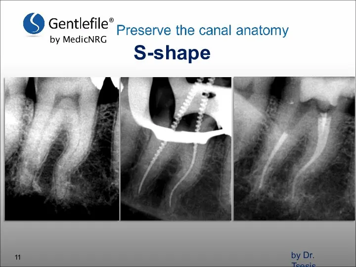 S-shape by Dr. Tsesis