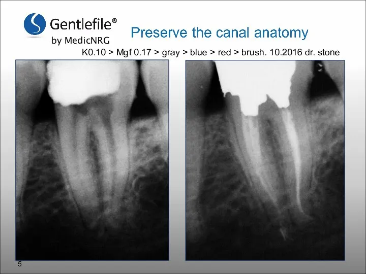 K0.10 > Mgf 0.17 > gray > blue > red > brush. 10.2016 dr. stone