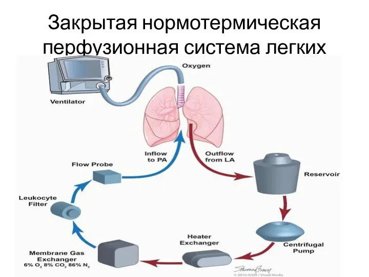 Закрытая нормотермическая перфузионная система легких