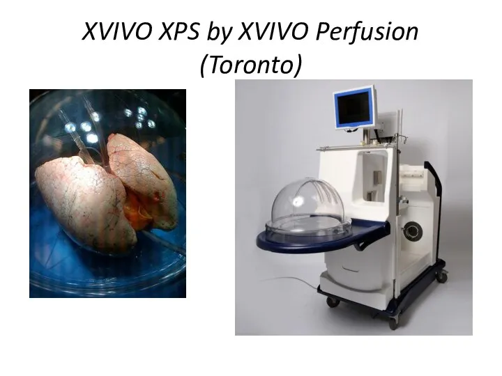 XVIVO XPS by XVIVO Perfusion (Toronto)