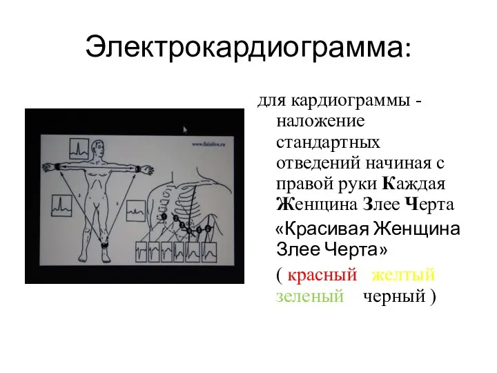 Электрокардиограмма: для кардиограммы - наложение стандартных отведений начиная с правой руки Каждая