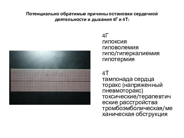 Потенциально обратимые причины остановки сердечной деятельности и дыхания 4Г и 4Т: 4Г