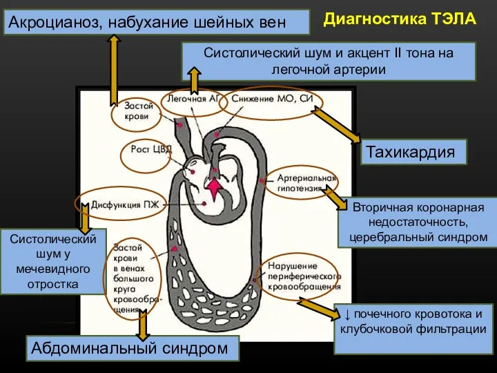 Акроцианоз, набухание шейных вен Тахикардия ↓ почечного кровотока и клубочковой фильтрации Вторичная