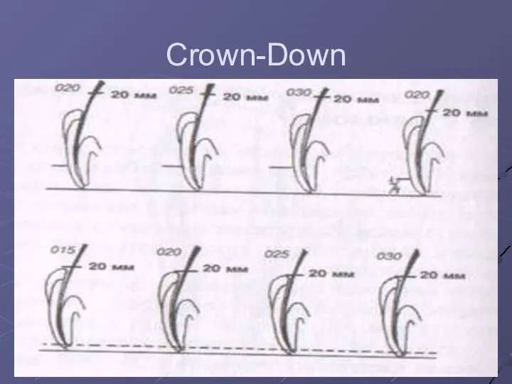 Crown-Down