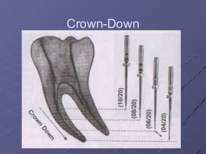 Crown-Down