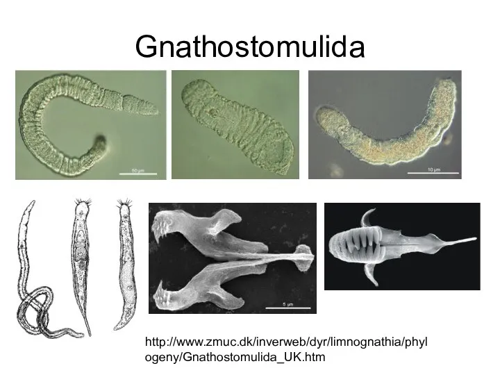 Gnathostomulida http://www.zmuc.dk/inverweb/dyr/limnognathia/phylogeny/Gnathostomulida_UK.htm