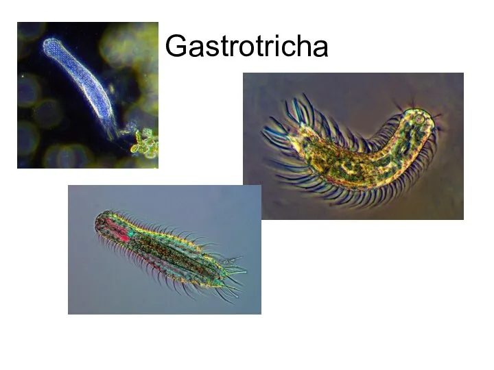 Gastrotricha