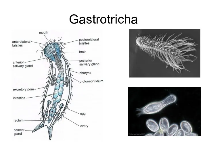 Gastrotricha