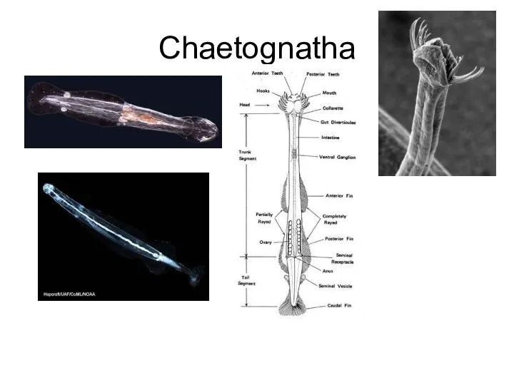 Chaetognatha