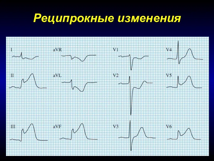 Реципрокные изменения