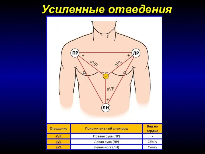 Усиленные отведения