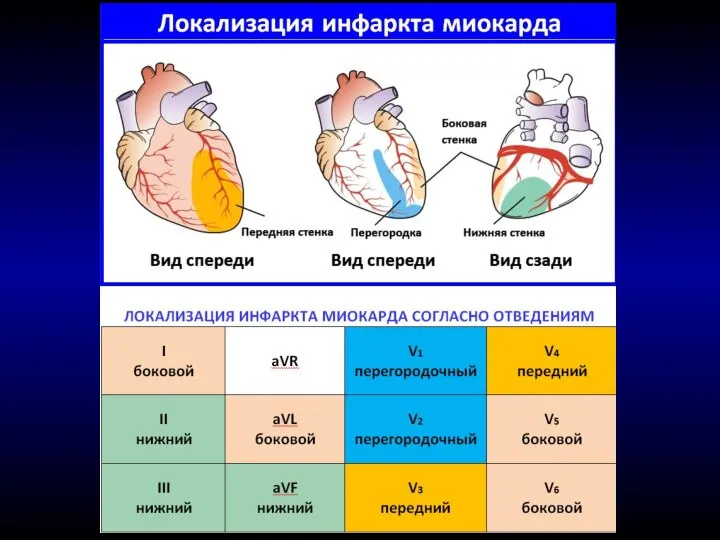 Грудные отведения