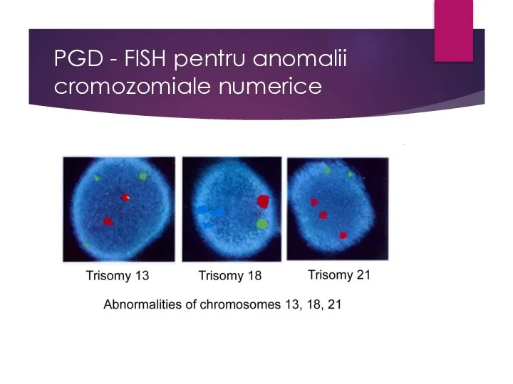 PGD - FISH pentru anomalii cromozomiale numerice