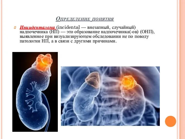 Определение понятия Инциденталома (incidental — внезапный, случайный) надпочечника (НП) — это образование