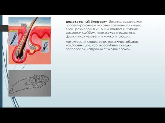 Демодекозный блефарит -болезнь, вызываемая паразитированием условно патогенного клеща. Клещ размером 0,2-0,5 мм