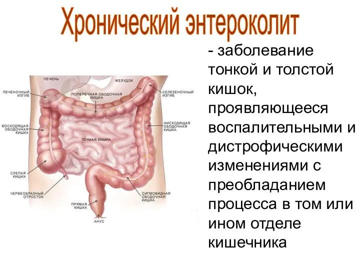 - заболевание тонкой и толстой кишок, проявляющееся воспалительными и дистрофическими изменениями с