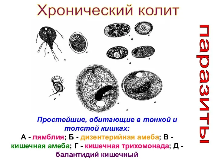 Простейшие, обитающие в тонкой и толстой кишках: А - лямблия; Б -