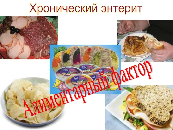 Хронический энтерит Алиментарный фактор