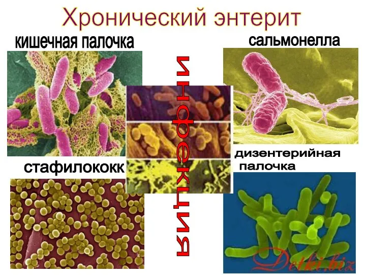 Хронический энтерит стафилококк кишечная палочка дизентерийная палочка сальмонелла инфекция