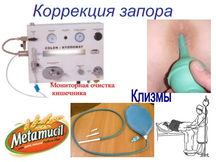 Коррекция запора Мониторная очистка кишечника Клизмы