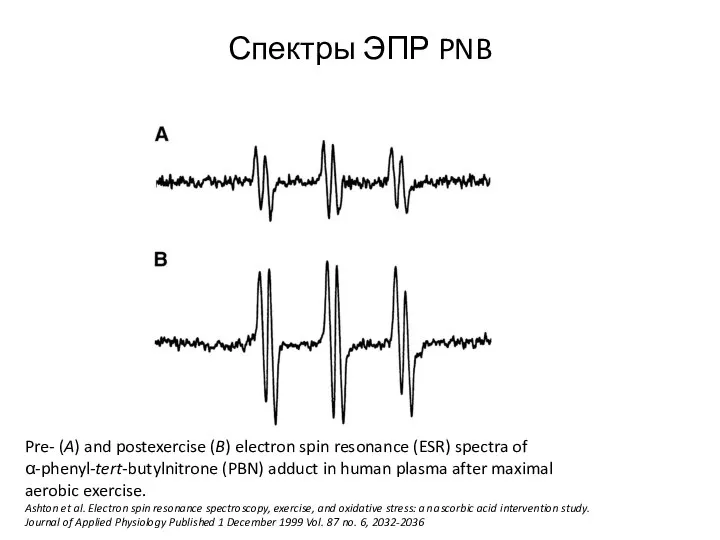 Спектры ЭПР PNB Pre- (A) and postexercise (B) electron spin resonance (ESR)