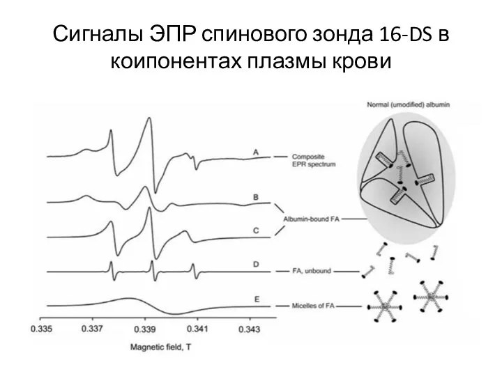 Сигналы ЭПР спинового зонда 16-DS в коипонентах плазмы крови