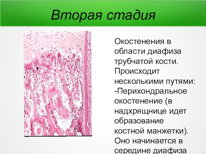 Вторая стадия Окостенения в области диафиза трубчатой кости. Происходит несколькими путями: -Перихондральное