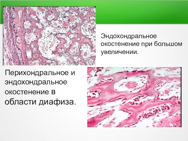 Перихондральное и эндохондральное окостенение в области диафиза. Эндохондральное окостенение при большом увеличении.