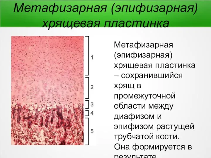 Метафизарная (эпифизарная) хрящевая пластинка Метафизарная (эпифизарная) хрящевая пластинка – сохранившийся хрящ в