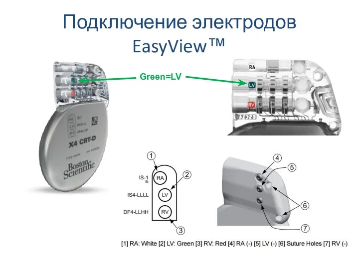 Подключение электродов EasyView™ Green=LV