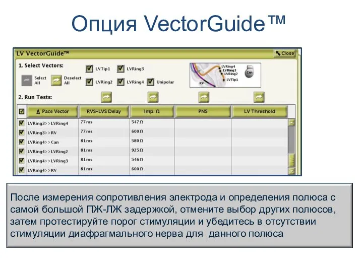 Опция VectorGuide™ После измерения сопротивления электрода и определения полюса с самой большой