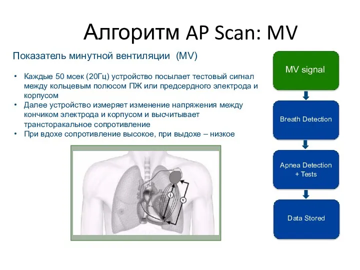 Алгоритм AP Scan: MV Breath Detection Apnea Detection + Tests Data Stored
