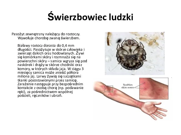 Świerzbowiec ludzki Pasożyt zewnętrzny należący do roztoczy. Wywołuje chorobę zwaną świerzbem. Białawy