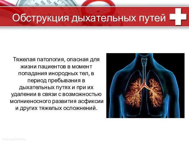 Обструкция дыхательных путей Тяжелая патология, опасная для жизни пациентов в момент попадания