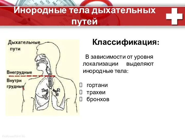 Инородные тела дыхательных путей Классификация: В зависимости от уровня локализации выделяют инородные тела: гортани трахеи бронхов