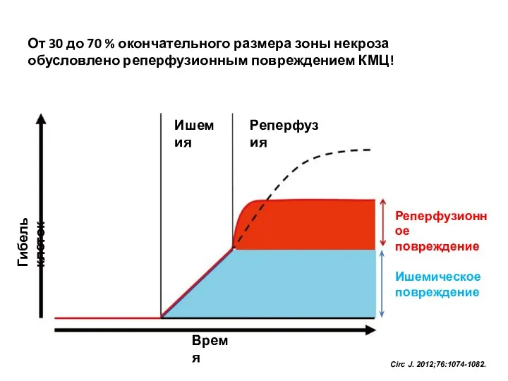 От 30 до 70 % окончательного размера зоны некроза обусловлено реперфузионным повреждением КМЦ! Circ J. 2012;76:1074-1082.