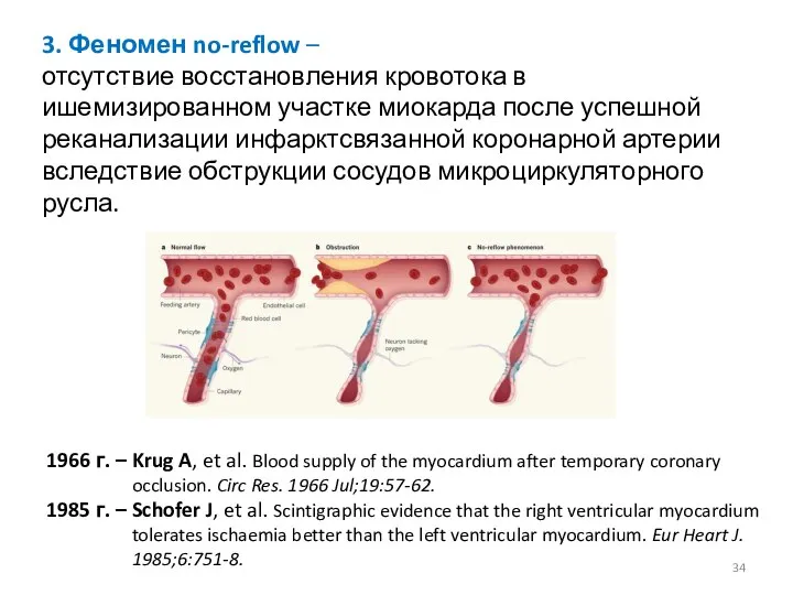 1966 г. – Krug A, et al. Blood supply of the myocardium