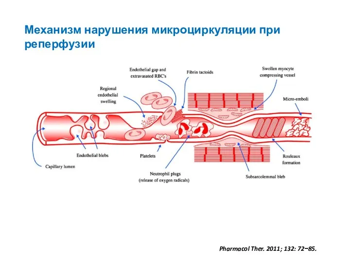 Механизм нарушения микроциркуляции при реперфузии Pharmacol Ther. 2011; 132: 72−85.