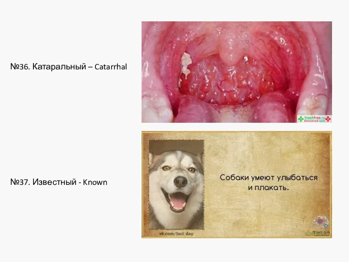 №36. Катаральный – Catarrhal №37. Известный - Known