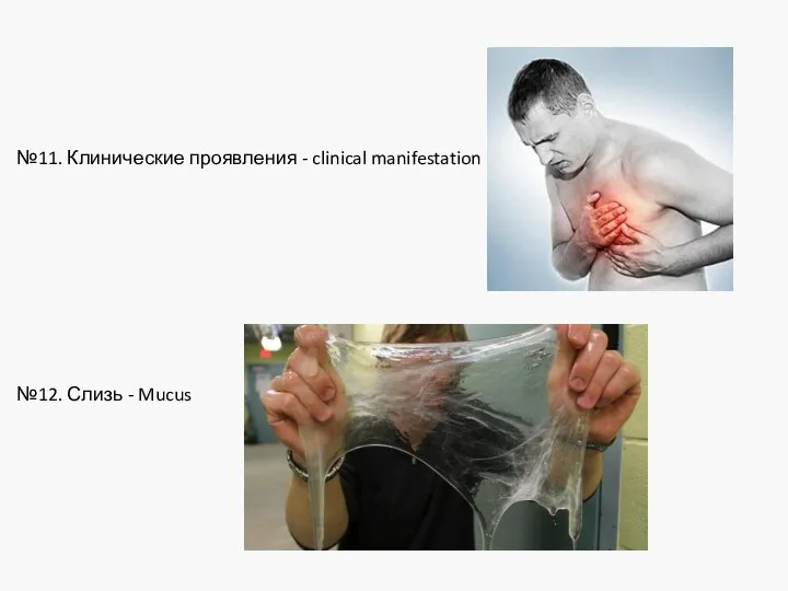 №11. Клинические проявления - clinical manifestation №12. Слизь - Mucus