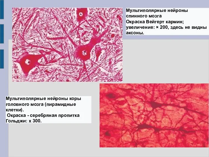 Мультиполярные нейроны спинного мозга Окраска Вейгерт кармин; увеличение: × 200, здесь не