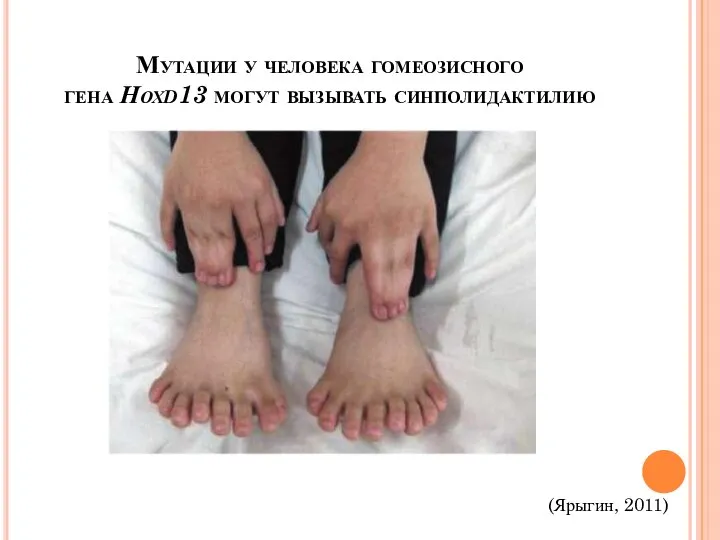 Мутации у человека гомеозисного гена Нохd13 могут вызывать синполидактилию (Ярыгин, 2011)