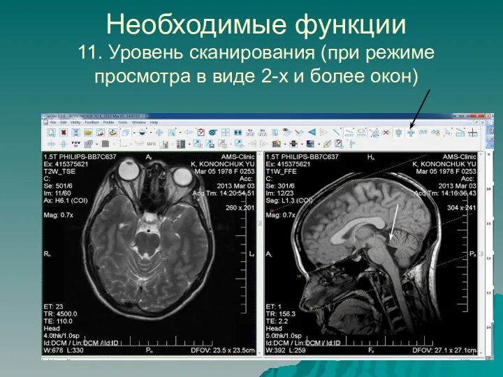 Необходимые функции 11. Уровень сканирования (при режиме просмотра в виде 2-х и более окон)