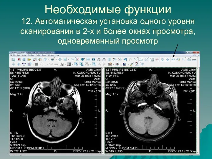 Необходимые функции 12. Автоматическая установка одного уровня сканирования в 2-х и более окнах просмотра, одновременный просмотр