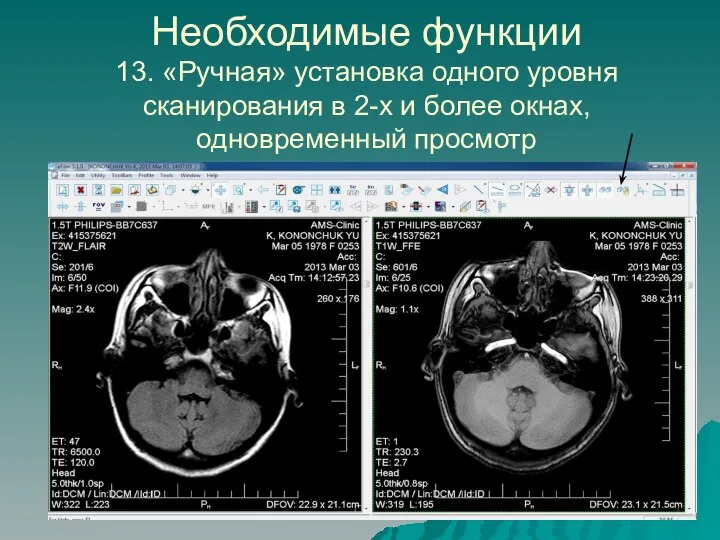 Необходимые функции 13. «Ручная» установка одного уровня сканирования в 2-х и более окнах, одновременный просмотр